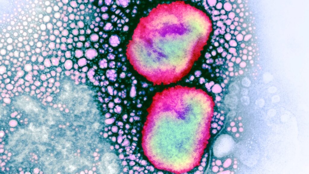 C0577417 Mpox virus particles TEM 16x9