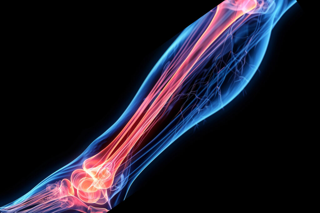 arteries leg AdobeStock 815595414 1500x1000 1